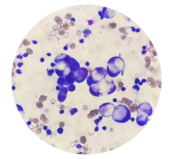 Oncology
